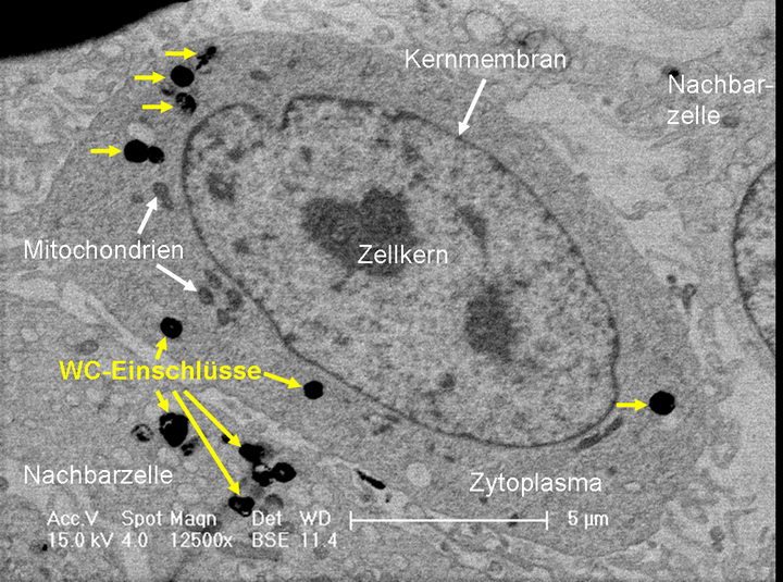 碳化鎢納米顆粒/碳化鎢粉會對人體健康有毒有害嗎？插圖